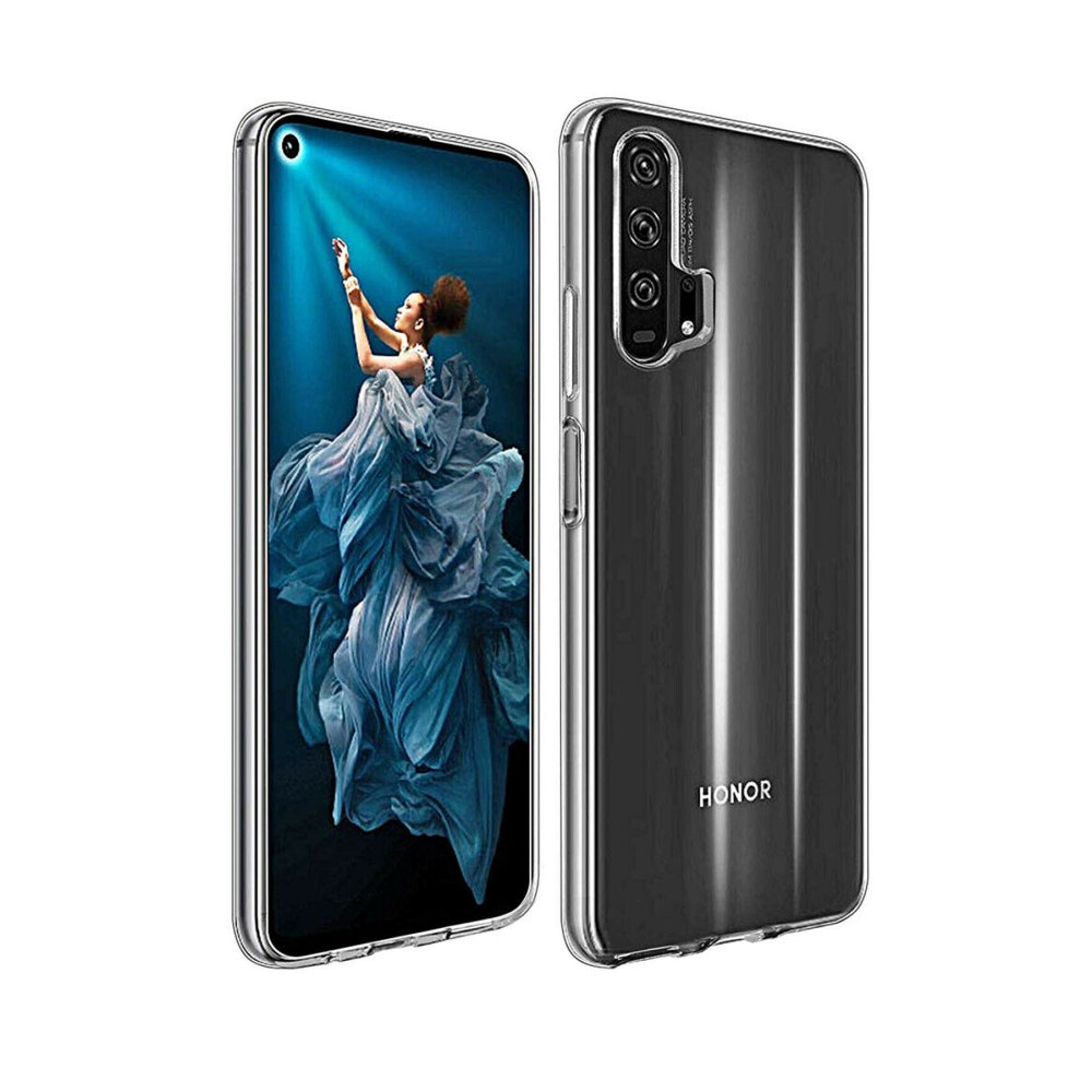 Newface Huawei Honor 90 Kılıf Lüx Şeffaf Silikon