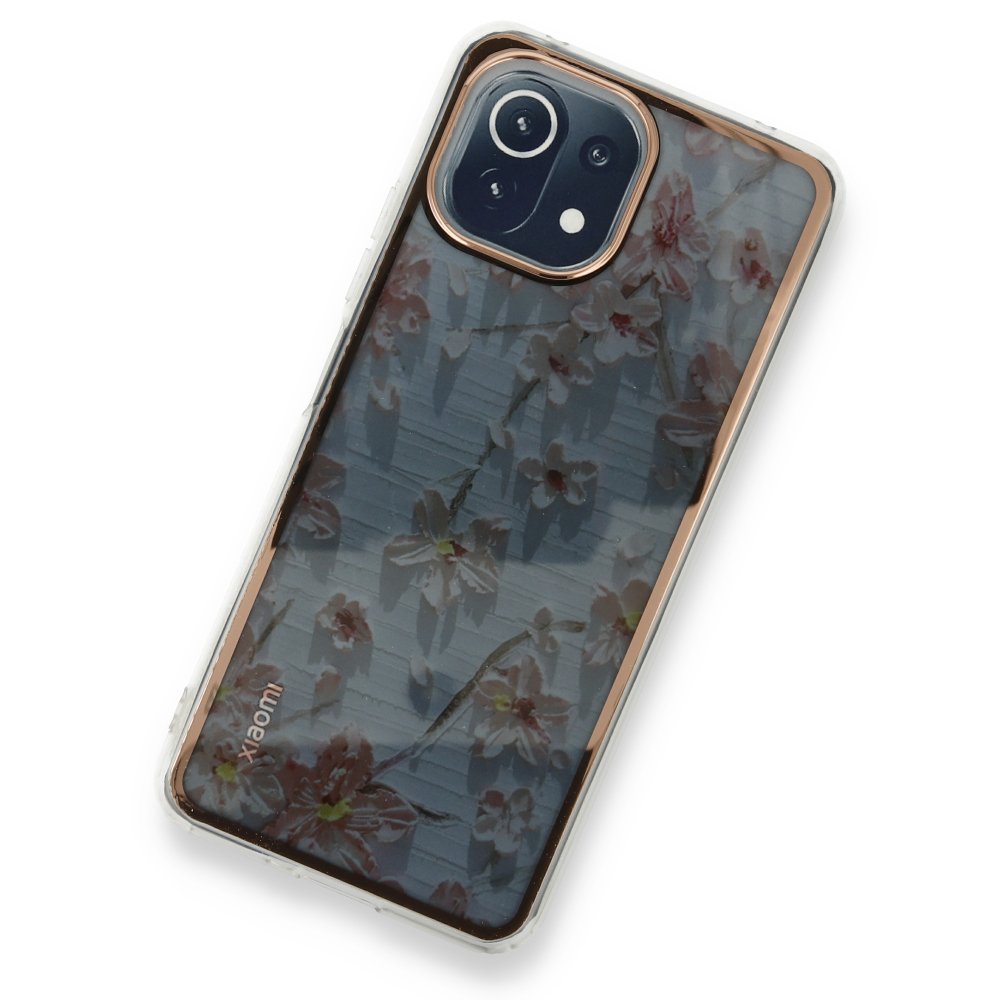 Newface Xiaomi Mİ 11 Lite Kılıf Çiçekli Silikon - Gri