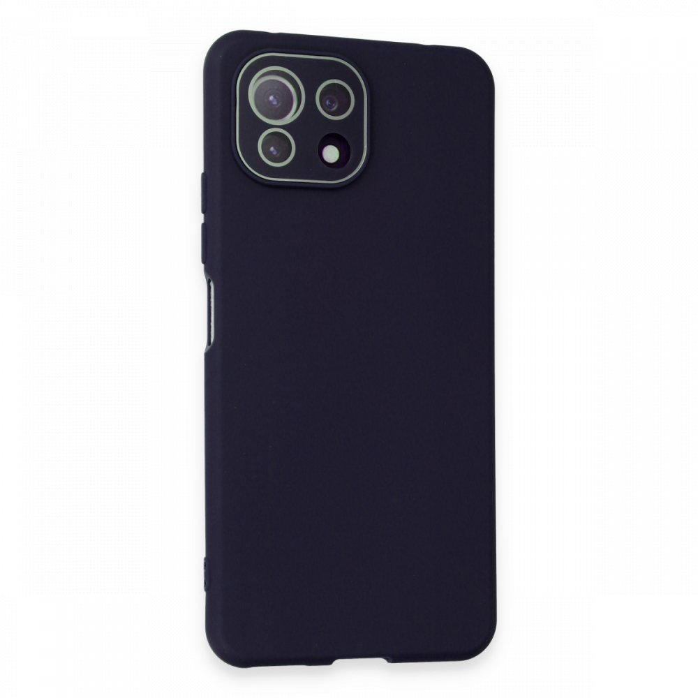 Newface Xiaomi Mİ 11 Lite Kılıf Lansman Glass Kapak - Lacivert
