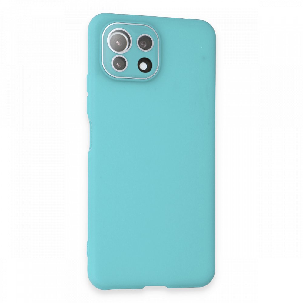 Newface Xiaomi Mİ 11 Lite Kılıf Lansman Glass Kapak - Turkuaz
