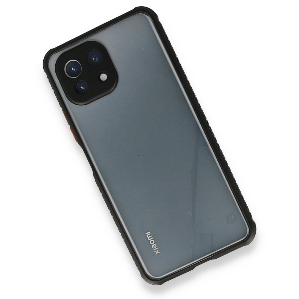 Newface Xiaomi Mİ 11 Lite Kılıf Miami Şeffaf Silikon - Siyah