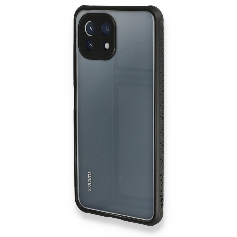 Newface Xiaomi Mİ 11 Lite Kılıf Miami Şeffaf Silikon - Siyah