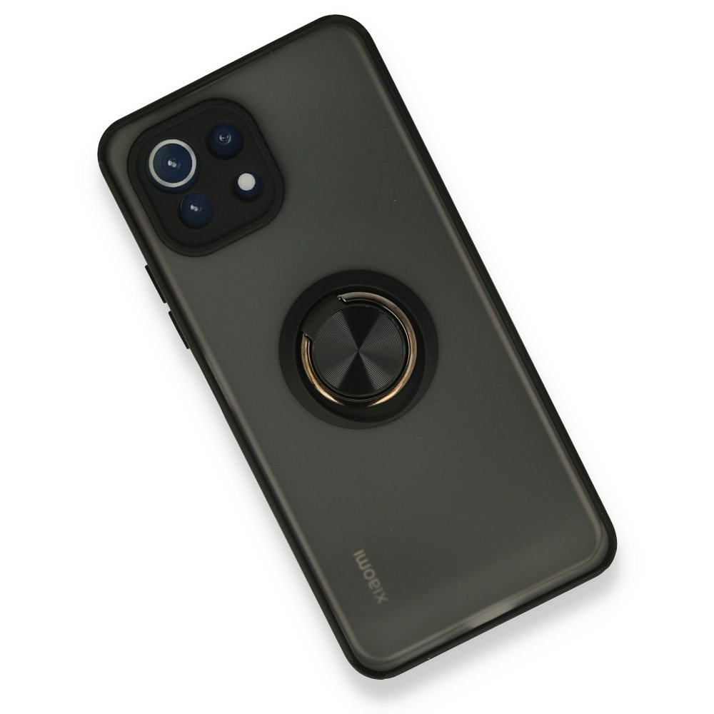Newface Xiaomi Mİ 11 Lite Kılıf Montreal Yüzüklü Silikon Kapak - Siyah