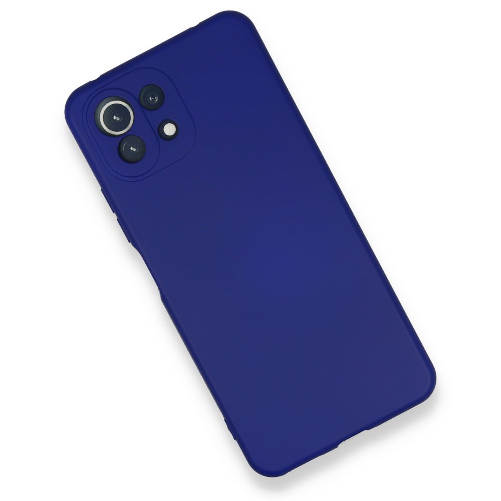 Newface Xiaomi Mİ 11 Lite Kılıf Nano içi Kadife  Silikon - Koyu Mavi