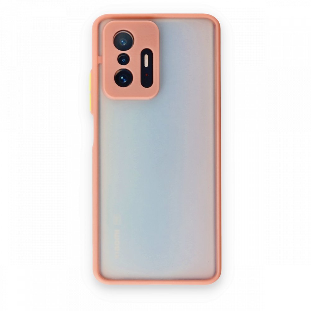 Newface Xiaomi Mi 11T Kılıf Montreal Silikon Kapak - Pembe