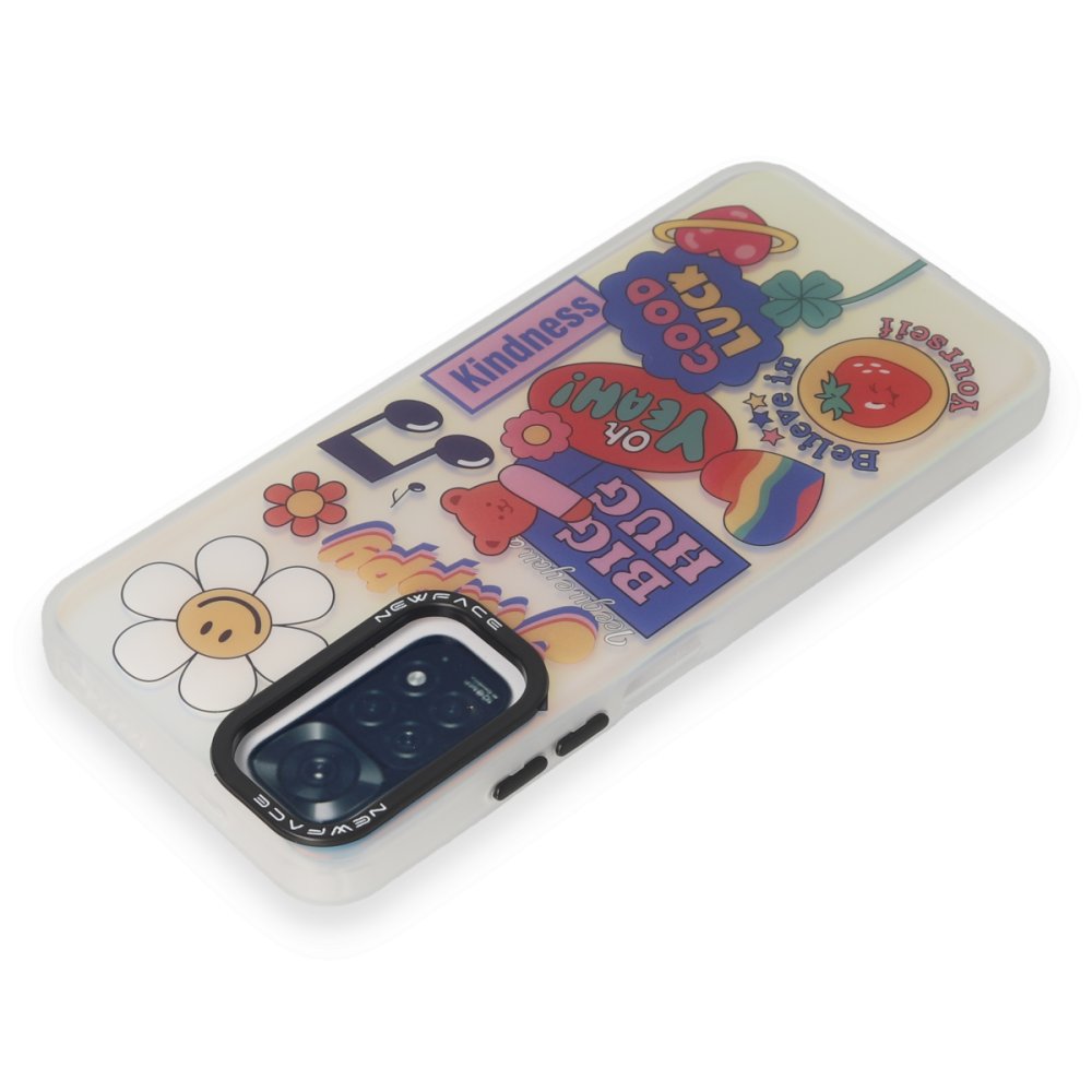 Newface Xiaomi Redmi Note 11 Kılıf Estoril Desenli Kapak - Estoril - 15