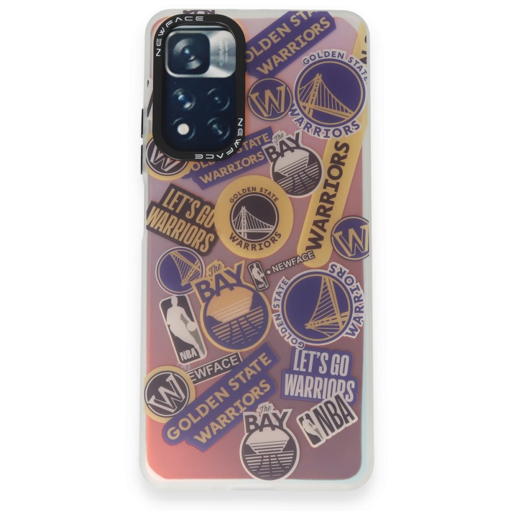 Newface Xiaomi Redmi Note 11 Pro Kılıf Estoril Desenli Kapak - Estoril - 13