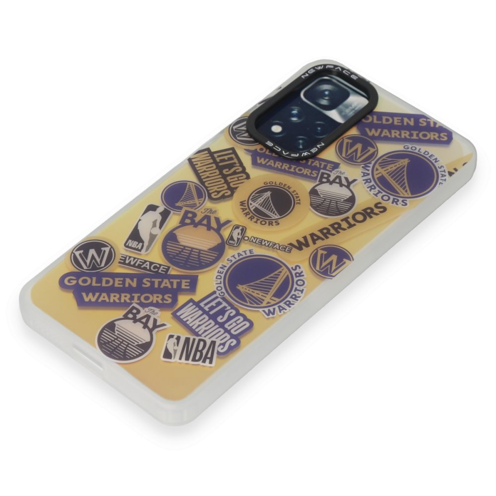 Newface Xiaomi Redmi Note 11 Pro Kılıf Estoril Desenli Kapak - Estoril - 13