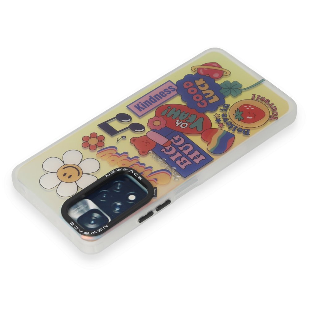 Newface Xiaomi Redmi Note 11 Pro Kılıf Estoril Desenli Kapak - Estoril - 15