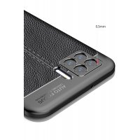 Newface Oppo A73 Kılıf Auto Focus Kapak - Siyah