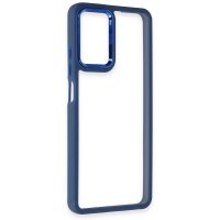 Newface Realme 10 4G Kılıf Dora Kapak - Mavi