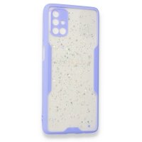 Newface Samsung Galaxy M51 Kılıf Platin Simli Silikon - Lila