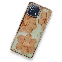 Newface Xiaomi Mİ 11 Lite Kılıf Çiçekli Silikon - Rose