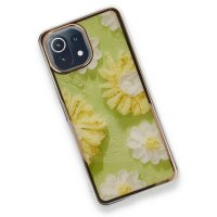 Newface Xiaomi Mİ 11 Lite Kılıf Çiçekli Silikon - Yeşil