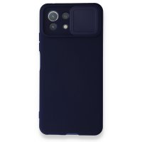 Newface Xiaomi Mİ 11 Lite Kılıf Color Lens Silikon - Lacivert