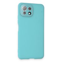 Newface Xiaomi Mİ 11 Lite Kılıf Lansman Glass Kapak - Turkuaz