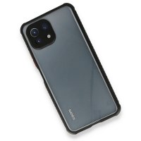 Newface Xiaomi Mİ 11 Lite Kılıf Miami Şeffaf Silikon - Siyah