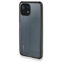 Newface Xiaomi Mİ 11 Lite Kılıf Miami Şeffaf Silikon - Siyah