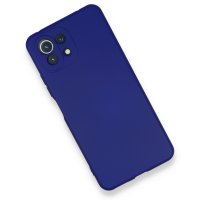 Newface Xiaomi Mİ 11 Lite Kılıf Nano içi Kadife  Silikon - Koyu Mavi
