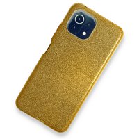 Newface Xiaomi Mİ 11 Lite Kılıf Simli Katmanlı Silikon - Gold