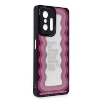 Newface Xiaomi Mi 11T Kılıf Mirror Desenli Kapak - Mirror - 11