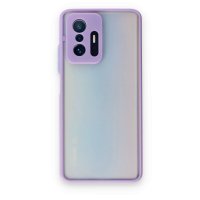 Newface Xiaomi Mi 11T Kılıf Montreal Silikon Kapak - Mor