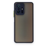 Newface Xiaomi Mi 11T Pro Kılıf Montreal Silikon Kapak - Lacivert