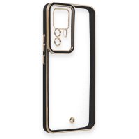 Newface Xiaomi Mi 12T Kılıf Liva Lens Silikon - Siyah