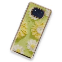 Newface Xiaomi Pocophone X3 Kılıf Çiçekli Silikon - Yeşil
