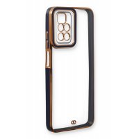 Newface Xiaomi Redmi Note 11 4G Kılıf Liva Lens Silikon - Mavi