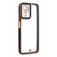 Newface Xiaomi Redmi Note 10 Kılıf Liva Lens Silikon - Mavi