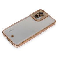 Newface Xiaomi Redmi Note 10 Kılıf Liva Lens Silikon - Pudra