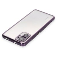 Newface Xiaomi Redmi Note 10S Kılıf Razer Lensli Silikon - Mor