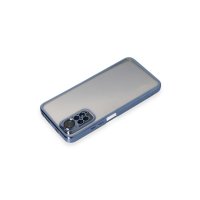 Newface Xiaomi Redmi Note 11 4G Kılıf Razer Lensli Silikon - Açık Mavi