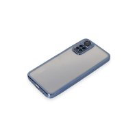 Newface Xiaomi Redmi Note 11 4G Kılıf Razer Lensli Silikon - Açık Mavi