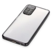 Newface Xiaomi Redmi Note 11 Kılıf Razer Lensli Silikon - Siyah