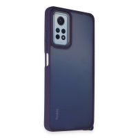 Newface Xiaomi Redmi Note 11 Pro Kılıf Elegant Kapak - Derin Mor