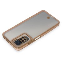 Newface Xiaomi Redmi Note 11S Kılıf Liva Lens Silikon - Pudra