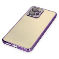 Newface Xiaomi Redmi Note 12 4G Kılıf Razer Lensli Silikon - Mor