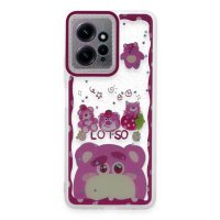 Newface Xiaomi Redmi Note 12 4G Kılıf Sweet Desenli Silikon Kapak - Pembe