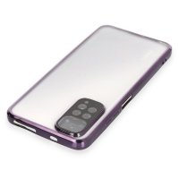 Newface Xiaomi Redmi Note 12S Kılıf Razer Lensli Silikon - Mor