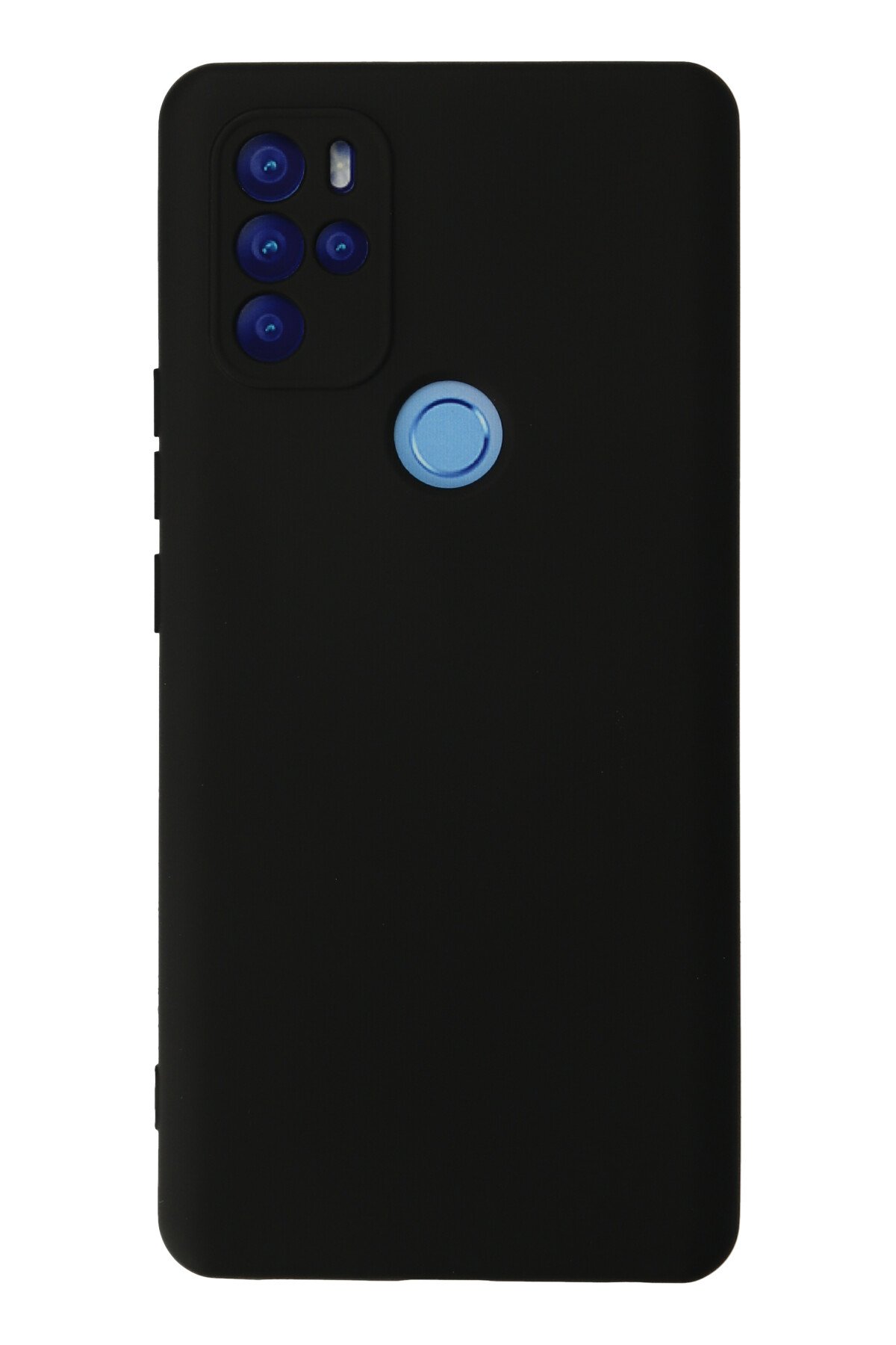 Newface Omix X300 Kılıf Nano içi Kadife Silikon - Koyu Yeşil