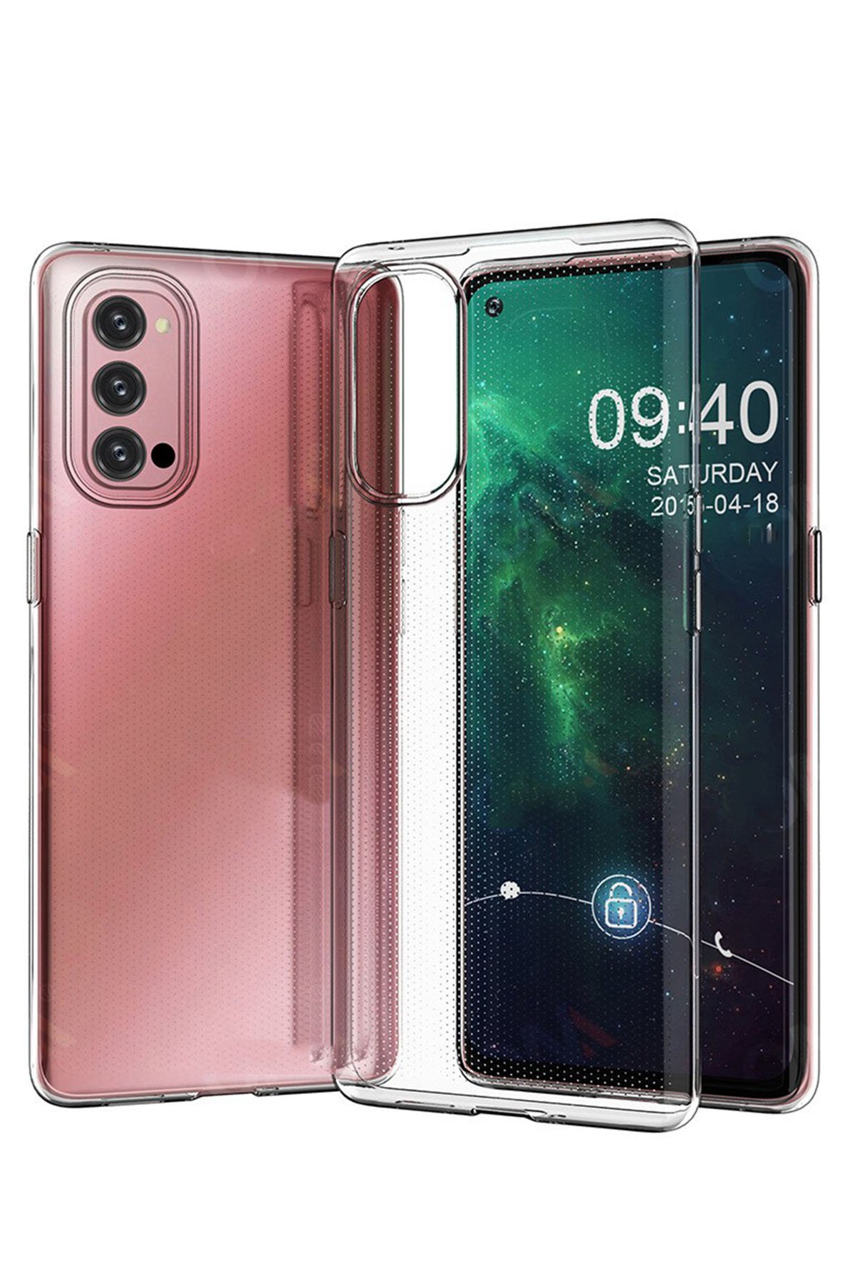 Newface Oppo Reno 4 Kılıf First Silikon - Gold