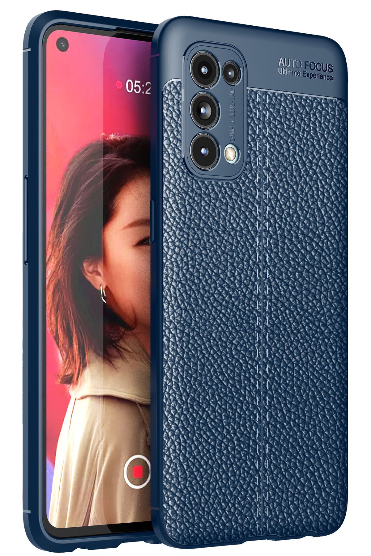 Newface Oppo Reno 5 Kılıf First Silikon - Gold