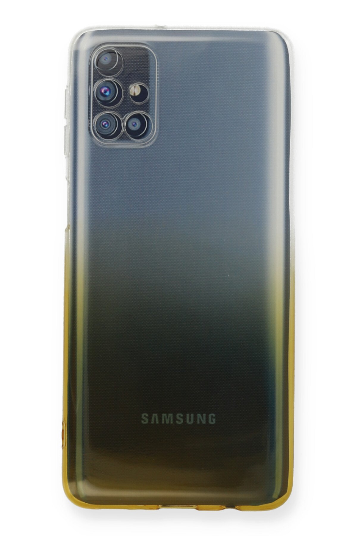 Newface Samsung Galaxy M51 Kılıf Zegna Yüzüklü Silikon Kapak - Koyu Yeşil