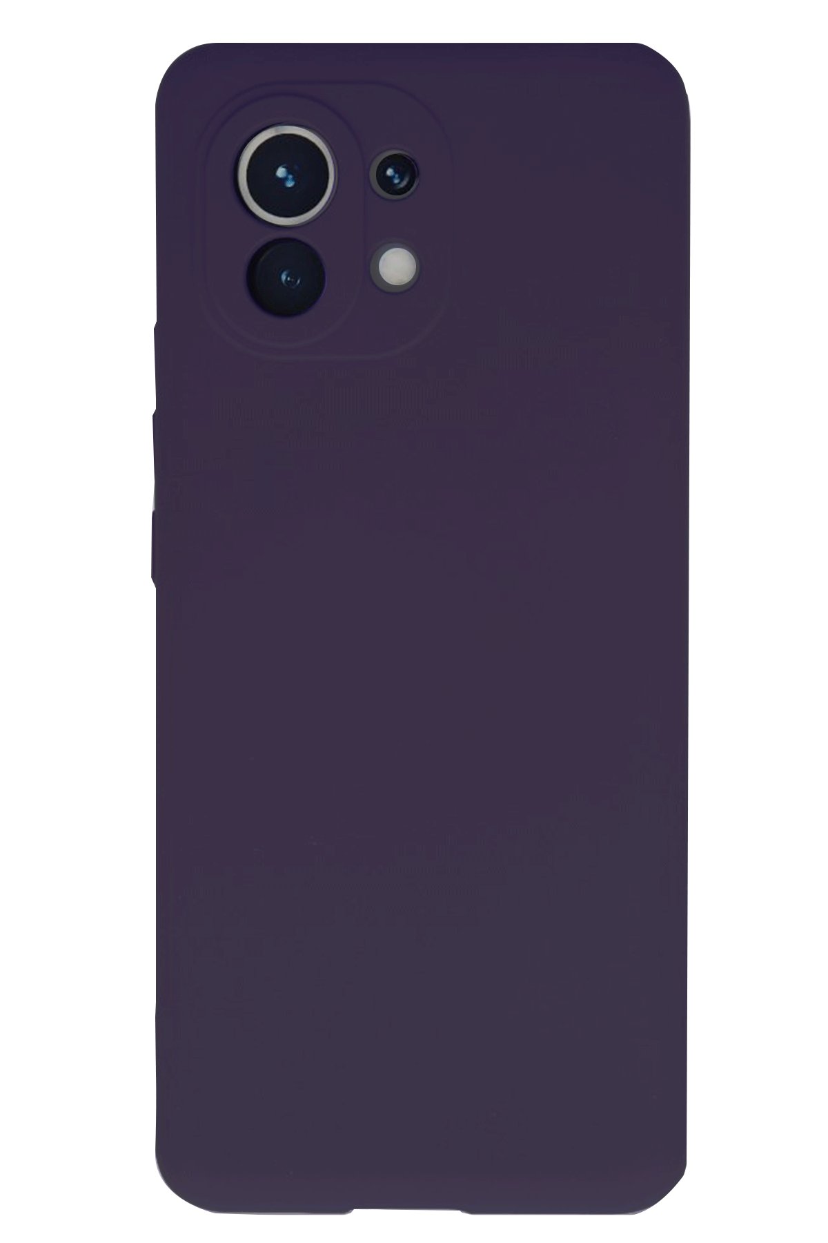 Newface Xiaomi Mi 11 Kılıf First Silikon - Gold