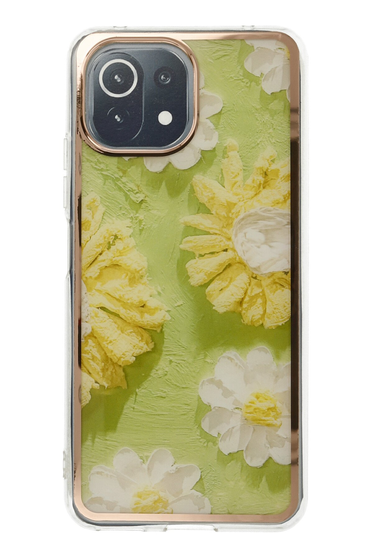 Newface Xiaomi Mİ 11 Lite Kılıf Zuma Kartvizitli Yüzüklü Silikon - Lacivert