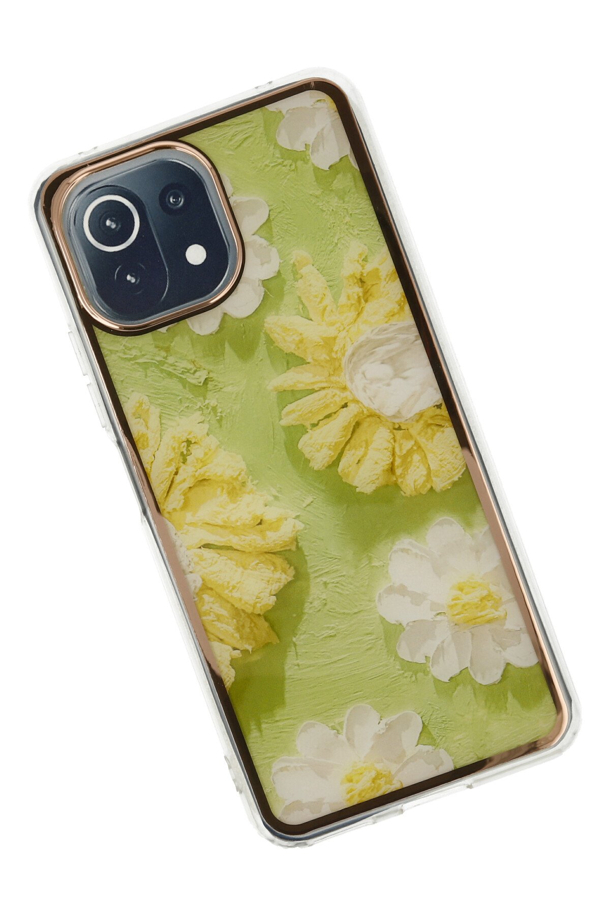 Newface Xiaomi Mİ 11 Lite Kılıf Zuma Kartvizitli Yüzüklü Silikon - Lacivert