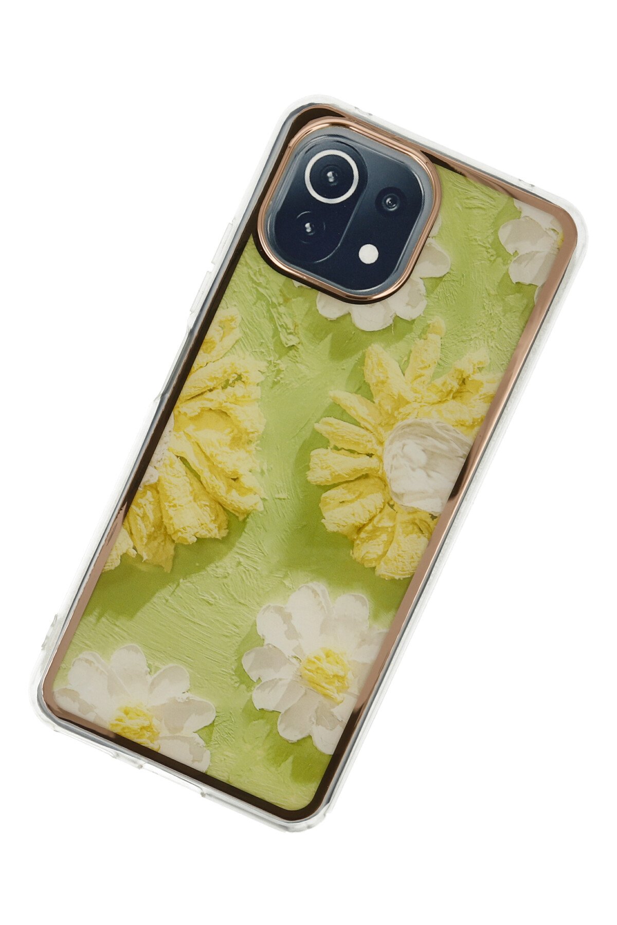 Newface Xiaomi Mİ 11 Lite Kılıf Zuma Kartvizitli Yüzüklü Silikon - Lacivert