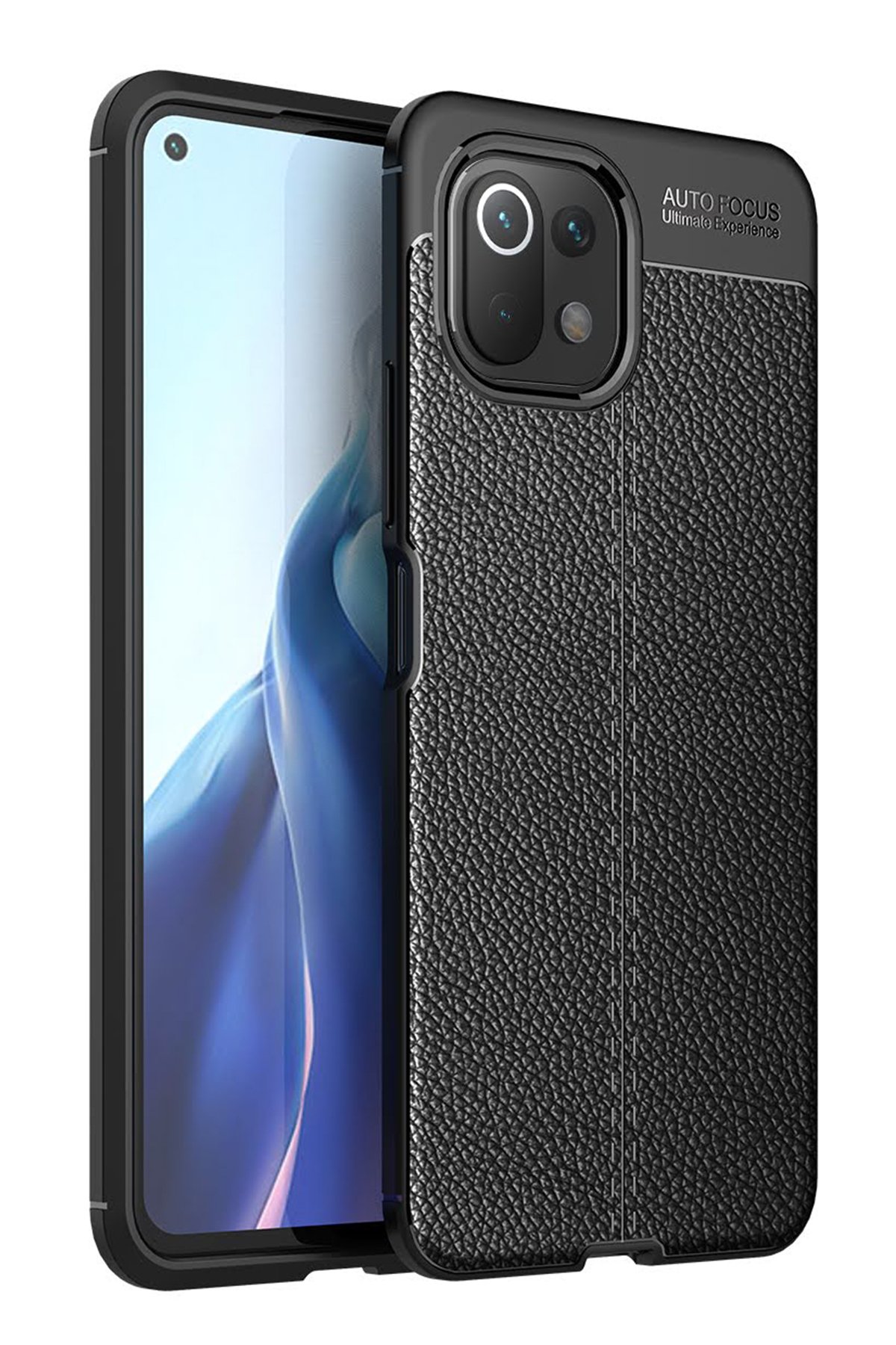 Newface Xiaomi Mİ 11 Lite Kılıf Sofya Yüzüklü Silikon Kapak - Gold